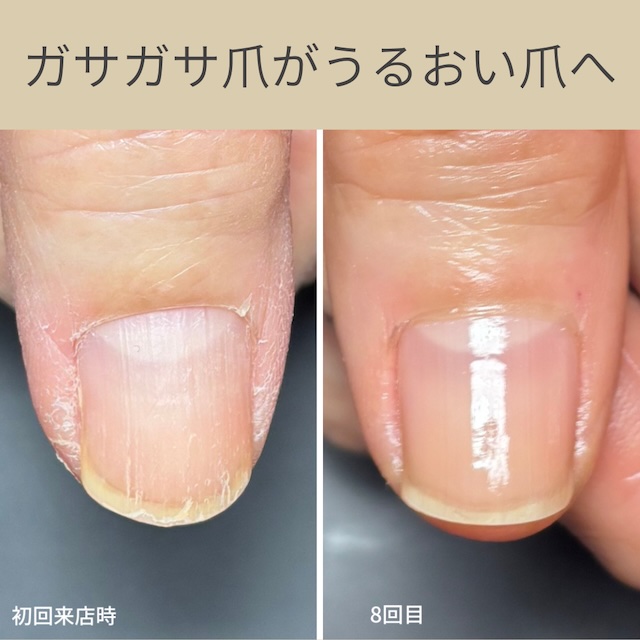富津市ネイルサロン|深爪・噛み爪・むしり爪でお悩みならMi dia|ミディア