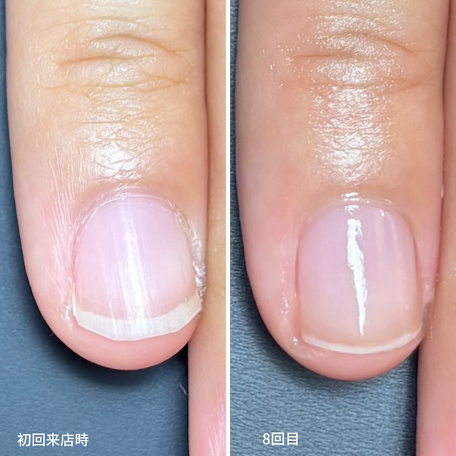 画像に alt 属性が指定されていません。ファイル名: S1.jpg